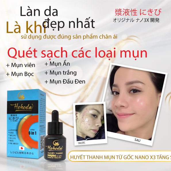 Huyết thanh mụn từ gốc nano 3x tầng sau Hohoda